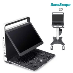 Sonoscape E2 Ultrasound Machine Portable Color Doppler Ultrasound System