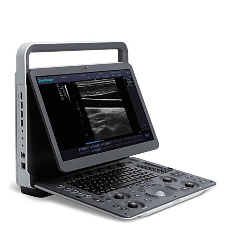Sistema portátil del ultrasonido de Doppler del color de la máquina de ultrasonido de Sonoscape E2
