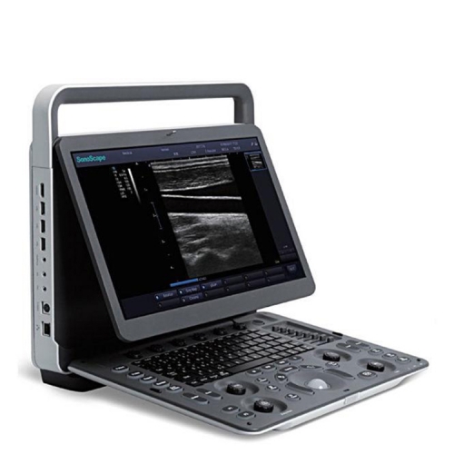 Système portatif d'ultrason de Doppler de couleur de machine d'ultrason de Sonoscape E2