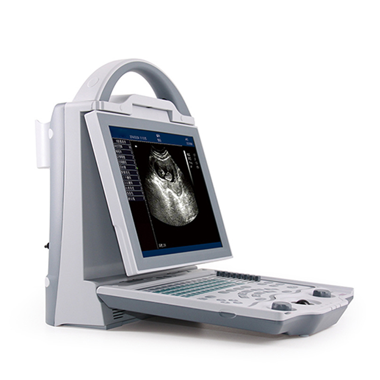 Machine à ultrasons portable B/W de vente chaude YSB5600