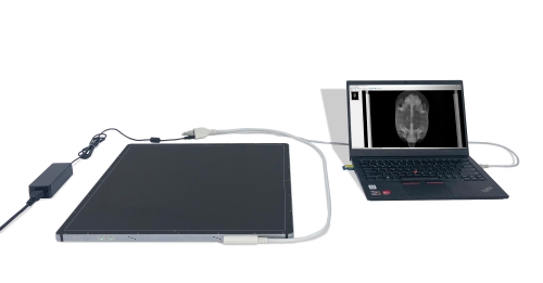 YSFPD4343V DR panels détecteurs à écran plat détecteur de rayons X filaire/sans fil pour la radiographie numérique