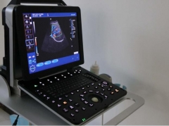 Good Quality Portable Color Ultrasound YSB-P6