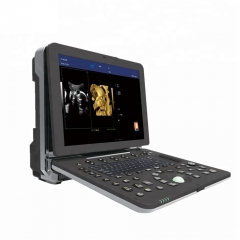 Good Quality Portable Color Ultrasound YSB-P6