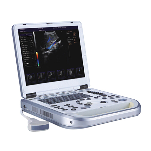 Laptop Color Doppler Ultrasound System YSB-M80