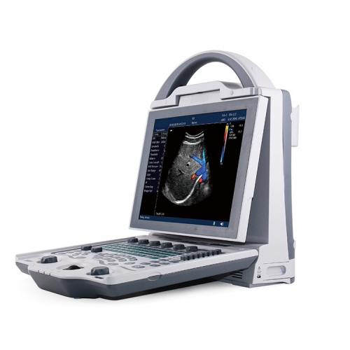 Portable Small Size Laptop Handheld Ultrasound YSB-DU12