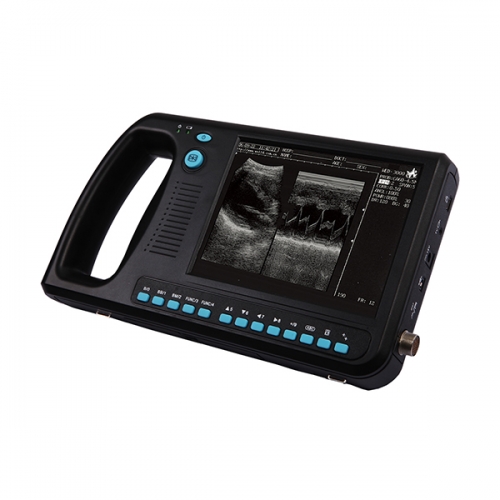 Escáner de ultrasonido en blanco y negro Palmsmart YSB3000