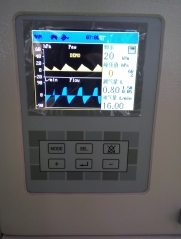 YSAV820 Quality mobile anesthesia machine ventilator with TFT Display