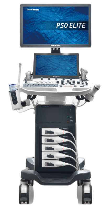 Sonoscape P50Elite trolley ultrasound machine scan with color doppler system