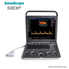 Exploración de la máquina de ultrasonido con carro Sonoscape P40 con sistema doppler color