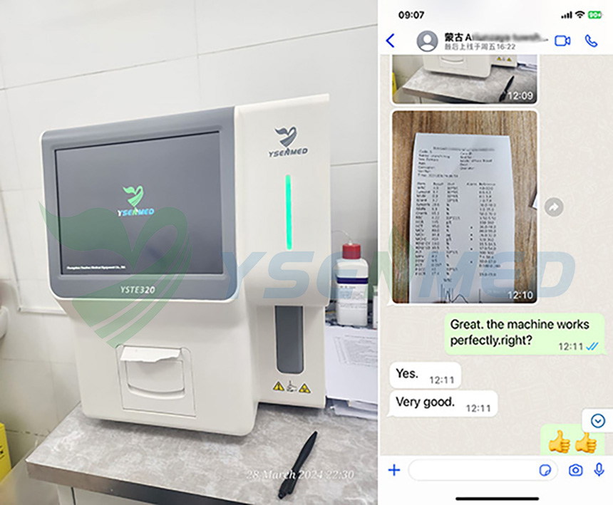 Mongolian doctor is happy with YSENMED YSTE320 auto hematology analyzer.
