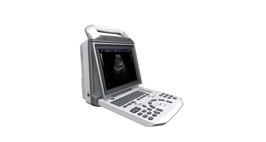 Georgian doctor satisfied with YSENMED YSB-i50 portable ultrasound machine