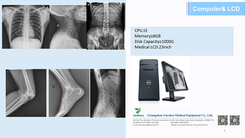 80kW 1000mA electric motorized double column digital x-ray system YSX-iDR80D