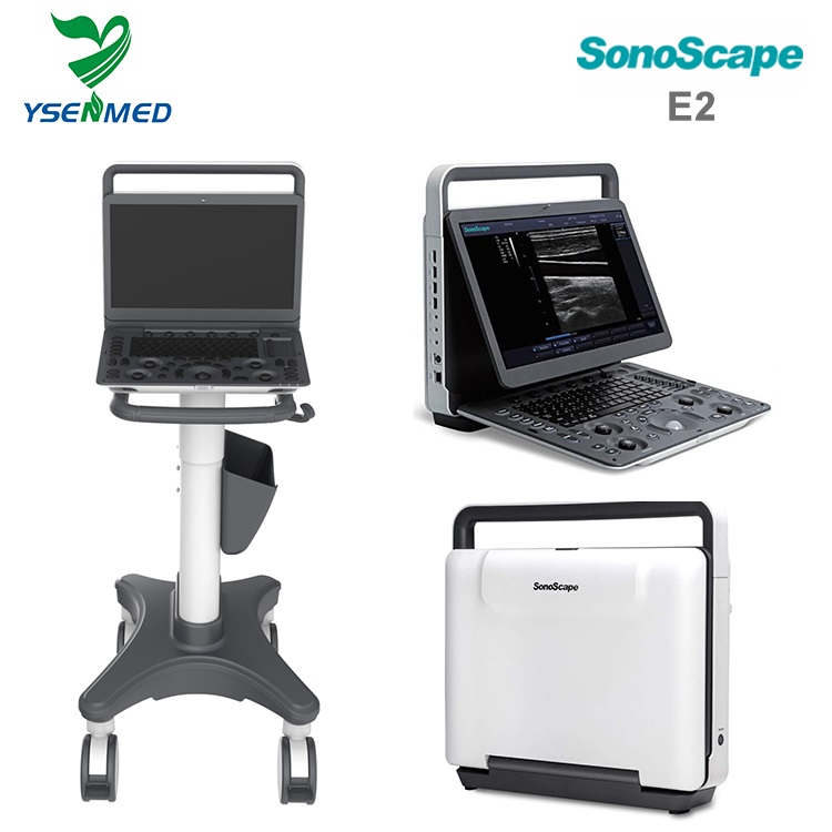 Système portatif d'ultrason de Doppler de couleur de machine d'ultrason de Sonoscape E2