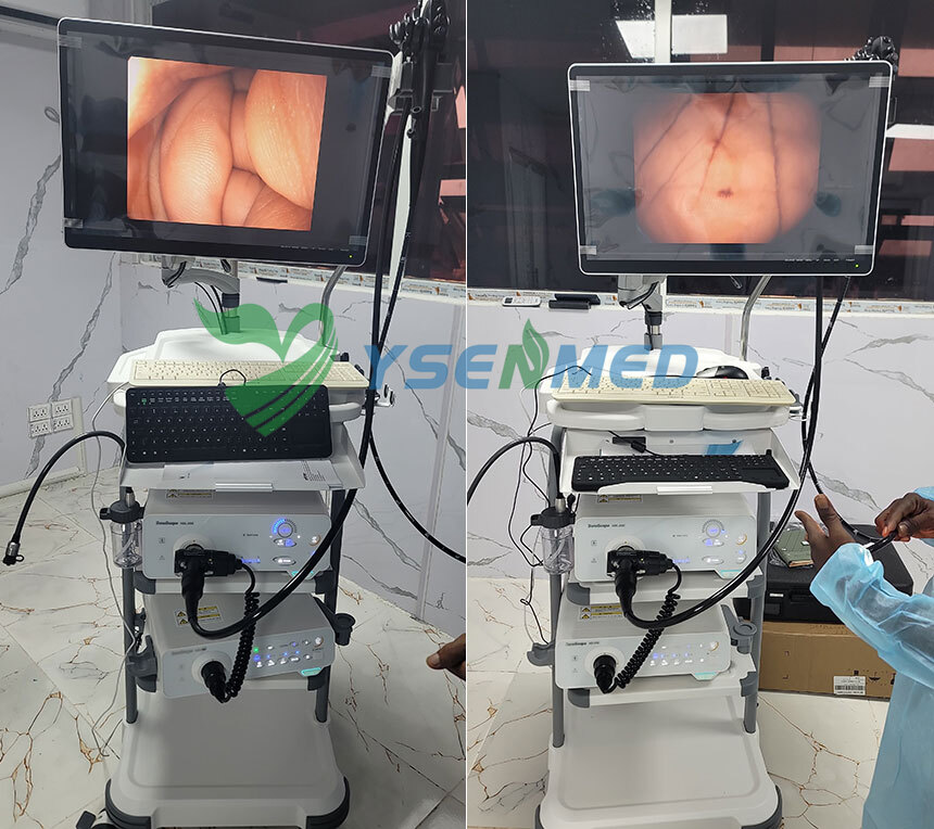 Эндоскопическая система Sonoscape HD-350 поставлена ​​в Либерию.