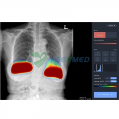 Medical Radiology Chest AI Diagnostic Software YSX-AI-C