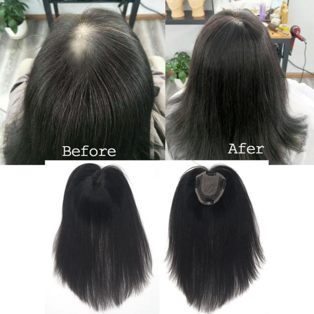 LyricalHair 10x11CM Real Human Hair Topper Clip On Hair Toppers Mono Base Crown Hairpiece For Thinning Hair Top Quality Hair Patch Toppers A2