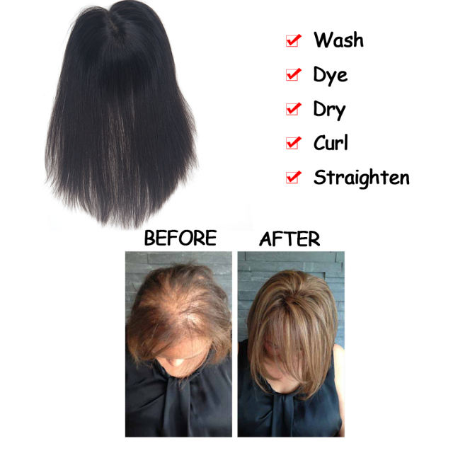 LyricalHair 10x11CM Real Human Hair Topper Clip On Hair Toppers Mono Base Crown Hairpiece For Thinning Hair Top Quality Hair Patch Toppers A2