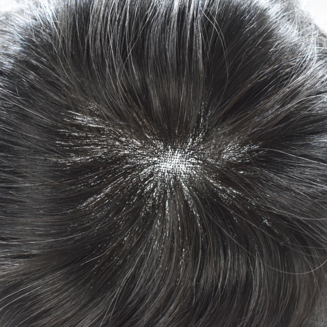 LyricalHair Men Toupee Super Thin French Lace Mens Toupee Remy Human Hair System Clear Poly Skin Around Wigs French Lace Hair System Easy Tape Attached Poly Skin Around Perimeter Realistic Best Men's Human Hair Toupee Unit For Men AUSTRALIA
