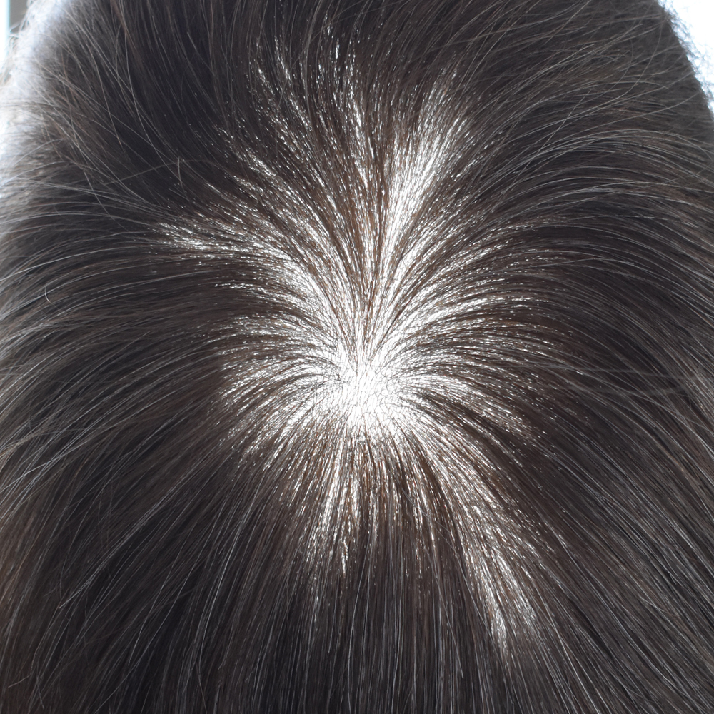【Goldman Hair】 0.06mm Ultra Thin Skin Hair System Mens Hair Pieces - Natural Hairline, Durable & Undetectable Human Hair Replacement