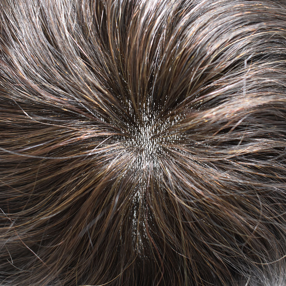 【Goldman Hair】Lace  Toupee For Men With Skin GM4- Thin Durable Skin, Indian Remy Hair - Natural Prosthesis Hair Replacement