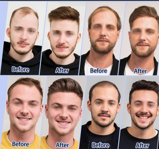 For bald men, wearing a wig makes a world of difference. Toupees can make men feel more confident.