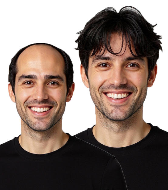 Wearing a toupee can make you feel more confident.