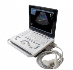 Yonker Cheap Portable Color Doppler Ultrasound Machine YK-UL8