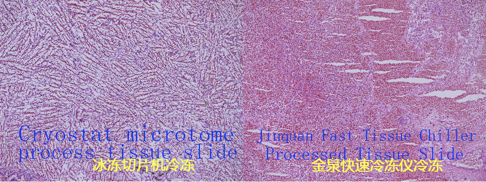 Histologie-Gewebegefrierschrank-FAC100