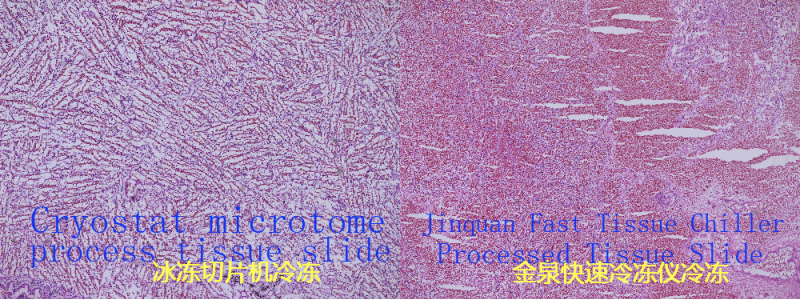 Congélateur de tissus histologiques-FAC100