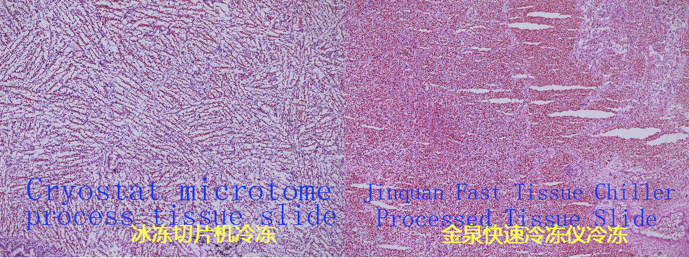Histology Tissue Freezer-FAC200