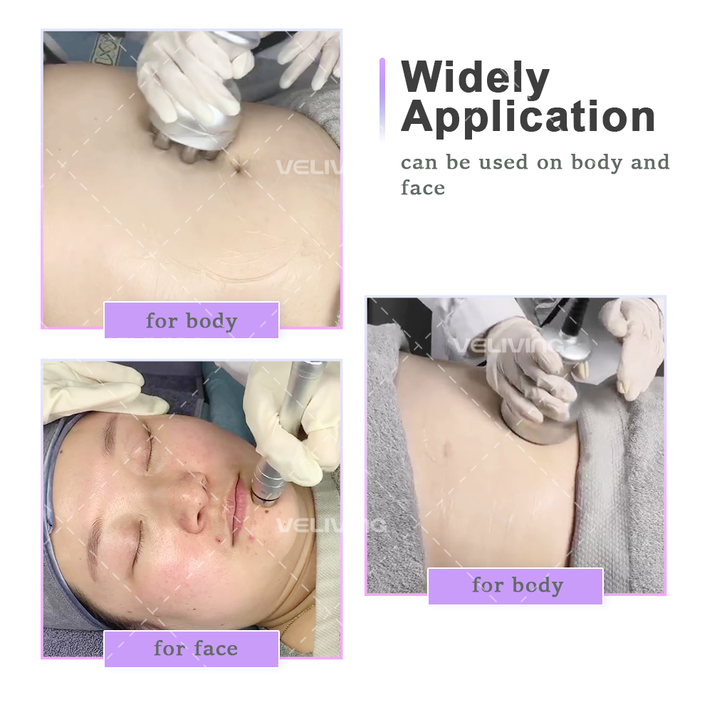 PROSLIM Fat Burst and Firming 40k RF Professionl 3 In 1