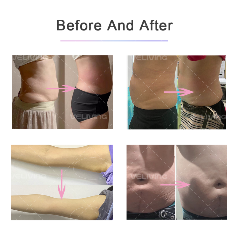 PROSLIM Slimming  Lipo Laser Paddle