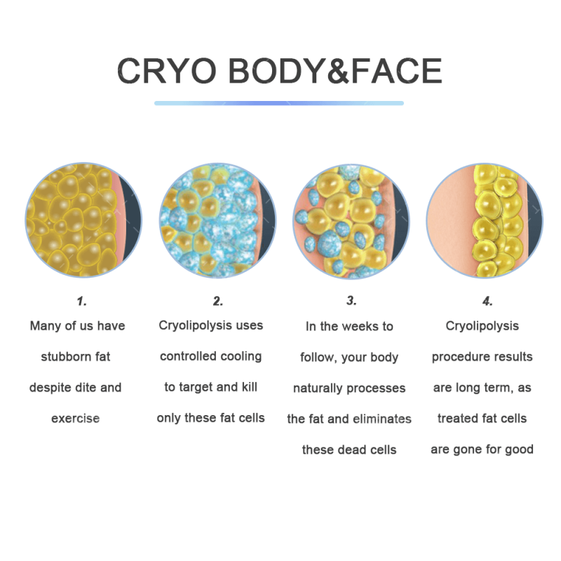 CRYOSCULPTING Multifunction 4 Handles Cryo Fat Freezing Cryolipolysis