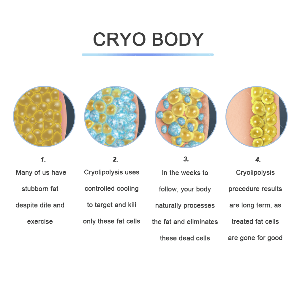 CRYOSCULPTING Fat Freezing Body Cavitation Machine With 5 Handle