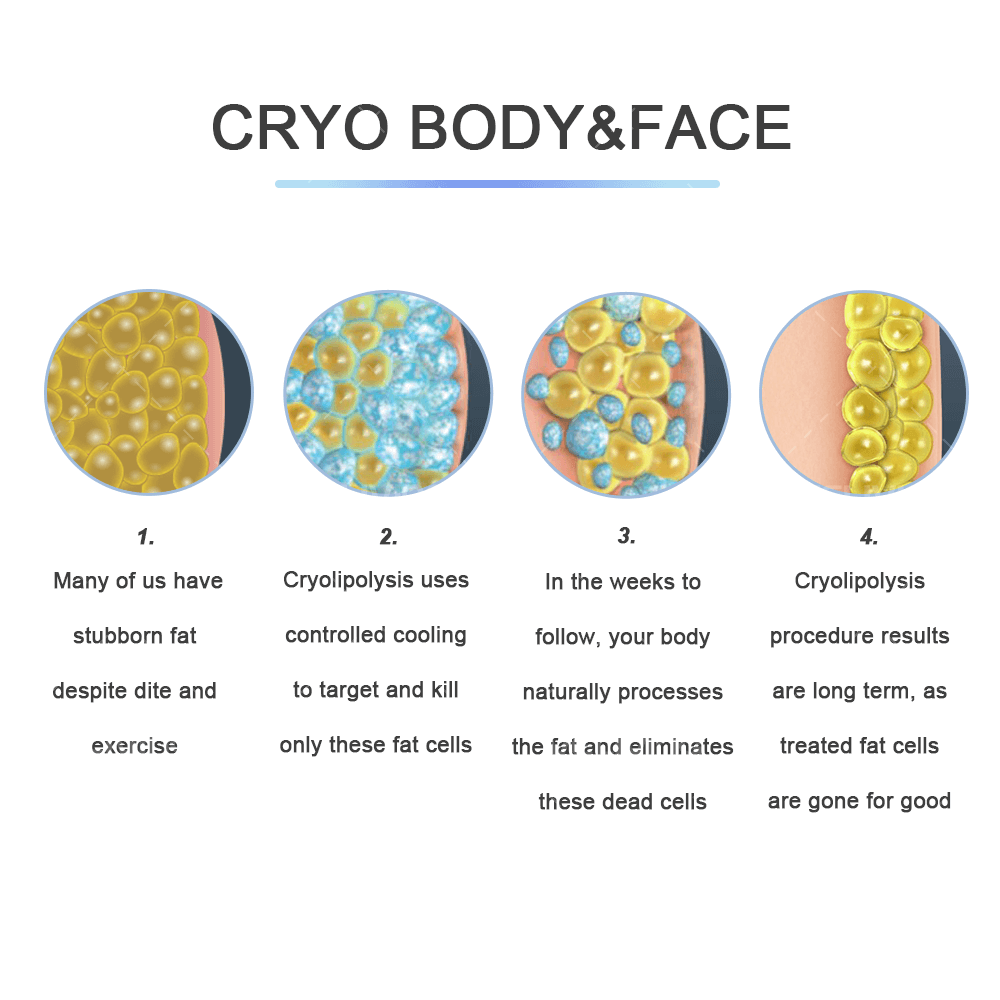 CRYOSCULPTING Fat Freezing Double Chin Cryolipolysis 3 Cryo Handle