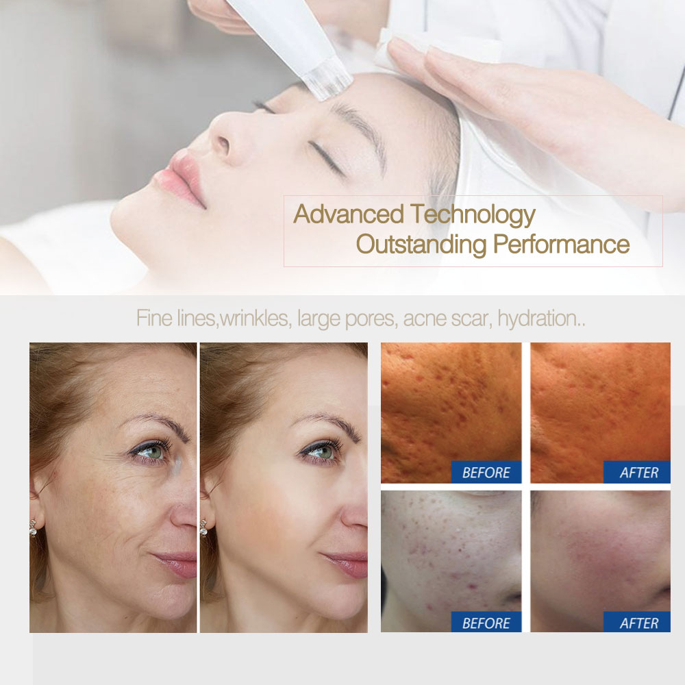 Aqua Pen Nano MicroNeedling Dermapen Hydra Derma Serum Delivery System with Flow Control Cartridge