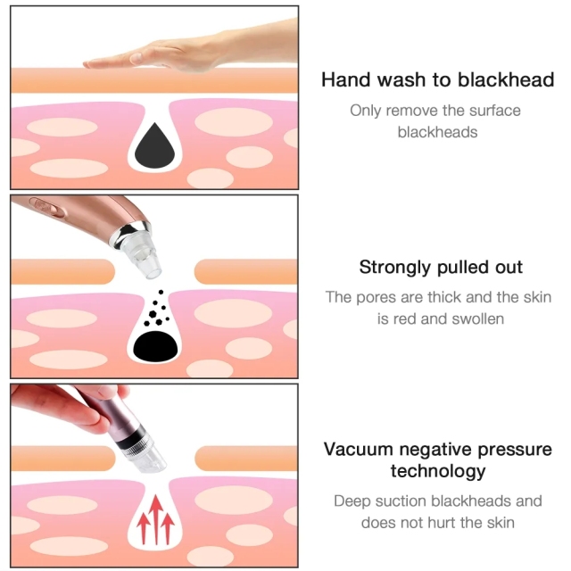 Dermabrasion Deep Clean Water Blackhead Removal Skin Rejuvenation Cleasing Aqua Peeling Oxygen Spray Blackhead Remover