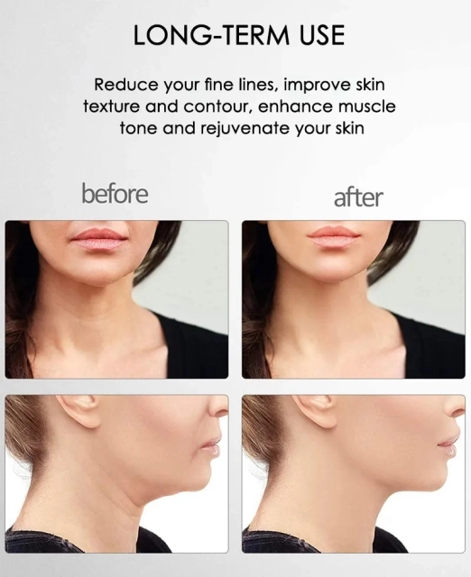 EMS Vibrating Anti Aging Wrinkle Face Lifting Massage Skin Tightening Toning Lift Rejuvenation Microcurrent Facial Device