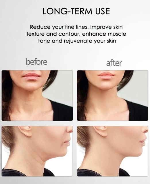 EMS Vibrating Anti Aging Wrinkle Face Lifting Massage Skin Tightening Toning Lift Rejuvenation Microcurrent Facial Device