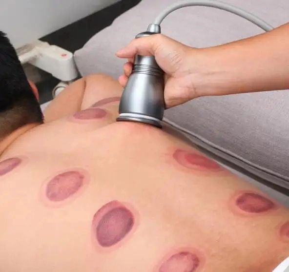 Guasha Painless Vibrating Massage Home Use Solve Headache Body Fatigue Absorb Serum Heating Shaping Electric Cupping Scraping Instrument