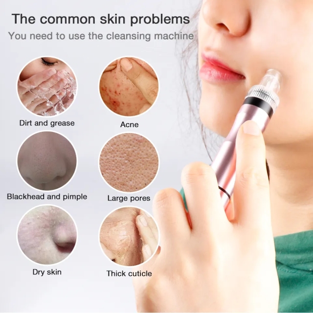 Dermabrasion Deep Clean Water Blackhead Removal Skin Rejuvenation Cleasing Aqua Peeling Oxygen Spray Blackhead Remover