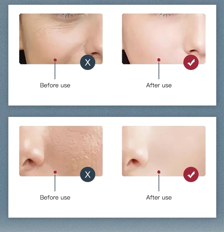 Professional LED Light Therapy Machine Salon 7 Color Cold Sprayer Mist Hydrating Moisturize SPA PDT LED Therapy Machine