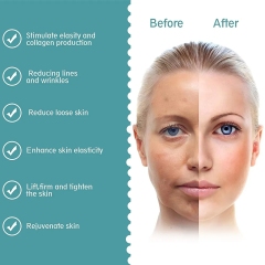 LED Stimulate Collagen Lifting Firming Ultrasonic Remove Wrinkle Fine Line Loose Skin Salon SPA Home Use Mini Hifu Device