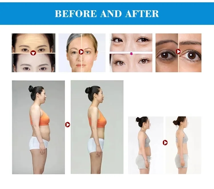 3in1 Beauty Equipment Pull V Face Tighten Skin Collagen Rejuvenation Anti Wrinkle Aging Double Chin Mini RF Machine