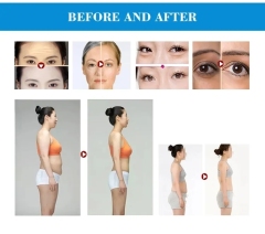 3in1 Beauty Equipment Pull V Face Tighten Skin Collagen Rejuvenation Anti Wrinkle Aging Double Chin Mini RF Machine