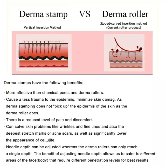 Factory Price Micro Needles Anti Wrinkle Hair Loss Scar Stretch Mark Non Adjustable and Adjustable 140pin Derma Stamp