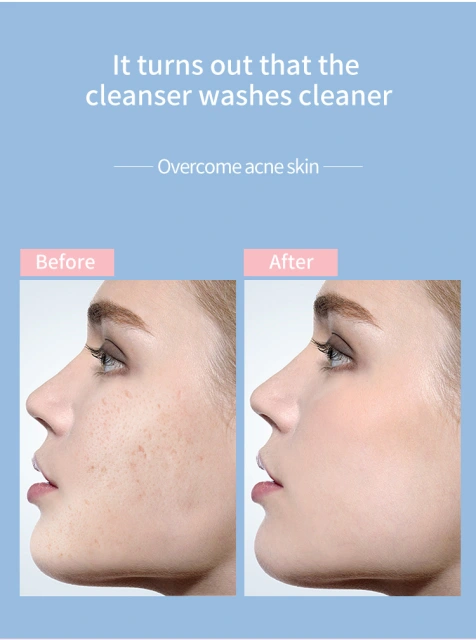 Deeply Skin Pore Cleaning Waterproof USB Rechargeable Beauty Silicone Facial Cleansing Brush