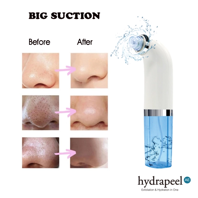 Hrdradermabrasion with Water Circulation Facial Blackhead Pore Peel Cleanse