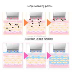 Ultrasonic Skin Scrubber Cleanser Face Cleansing Acne Removal Facial Massager Ultrasound Peeling