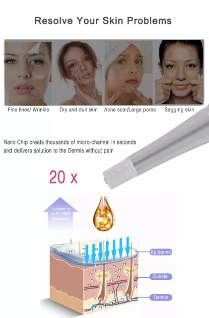 Monocrystal Silicon Derma Nano Pen Meso Microneedle for Wrinkle Removal
